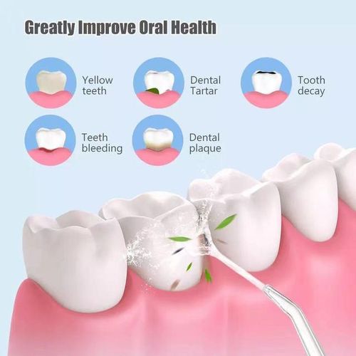 4 nozzles Oral Irrigator Portable Dental Water Flosser USB Rechargeable Water Jet Floss